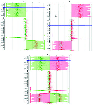 GenomePlex® Complete Whole Genome Amplification (WGA) Kit Optimized kit with enzyme for amplifying a variety of DNA including FFPE tissue